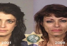 Before and after methamphetamine