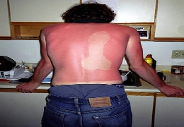 Hilarious examples of bad tans