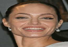 Plastic surgery victim angelina jolie