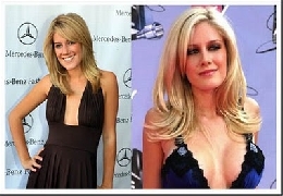 Img21: celebrities before and after boob jobs